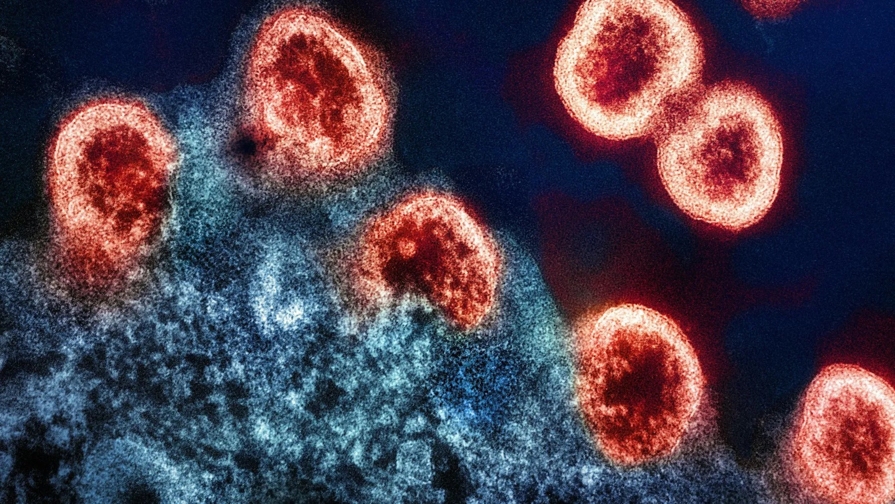 Rejected Twice, Approved on the Third Try: The Tumor-Injected Virus That Just Cleared the FDA — Tech Arcade